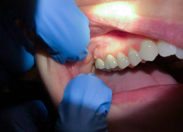 Best After-Hours Dental Trauma Care in Folkston, GA