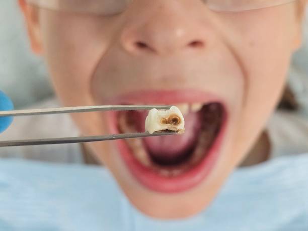 Best Emergency Gum Treatment in Folkston, GA